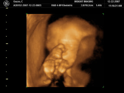 EVA = life; living one... JANETTE = God is Gracious...: 2D-3D-4D