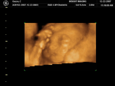 EVA = life; living one... JANETTE = God is Gracious...: 2D-3D-4D