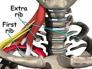 Cervical Rib Image