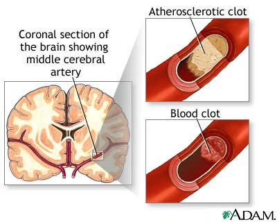 Herbal remedies to improve brain function photo 8