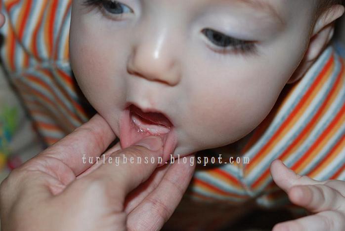 [firsttoothwm.JPG]