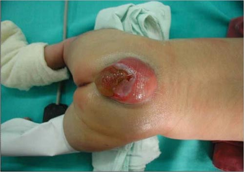 [glifosato-+malformaciones4.jpg]