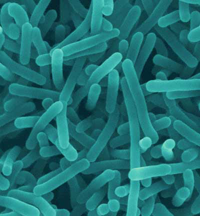 listeria listeria