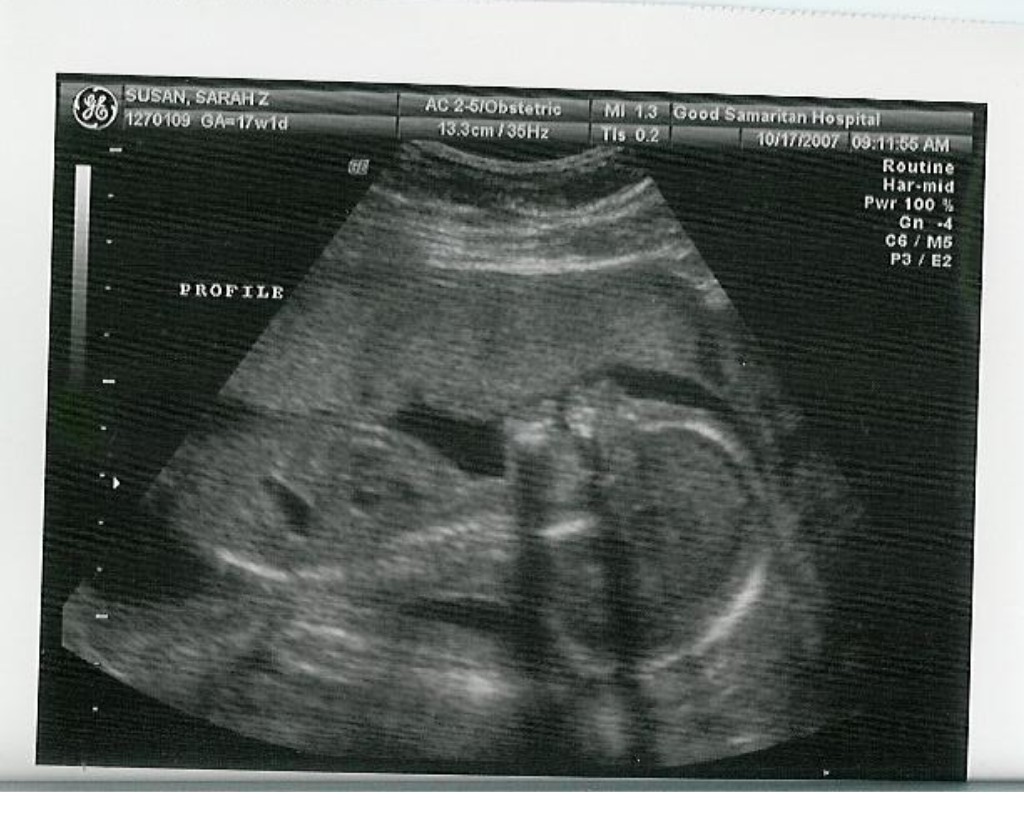 [baby.jpg]