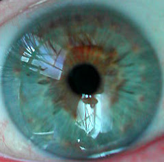 My Eye