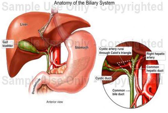 Calot Triangle In Cholecystectomy Diets