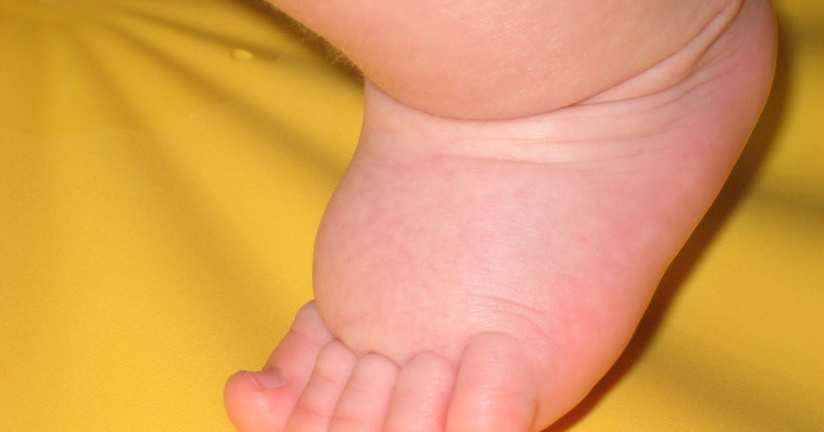 The Muir Family Blog Cole's Fat Feet
