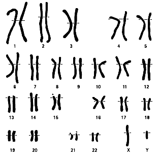 the chromosomes of a human