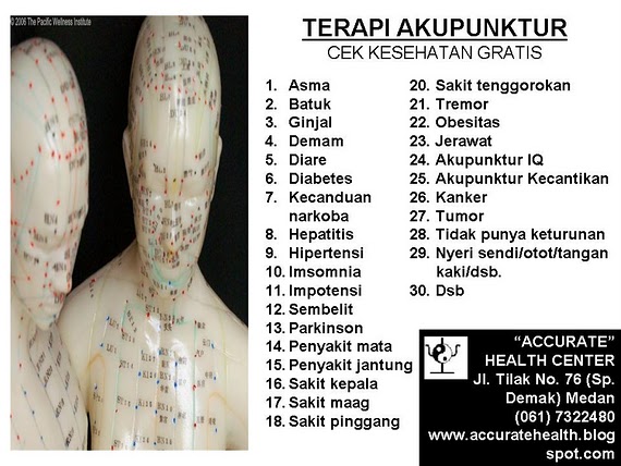 TERAPI AKUPUNKTUR