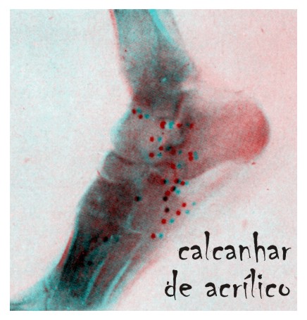 Calcanhar de Acrílico