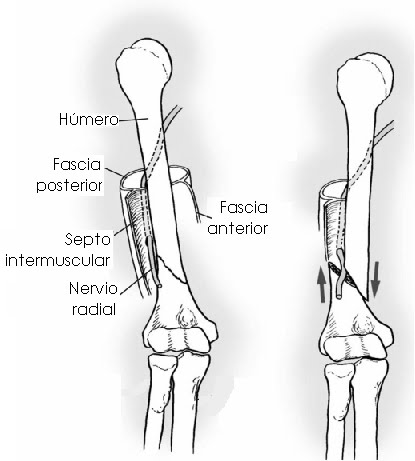 FRACTORA DE HUMERO DISTAL EPUB DOWNLOAD FRACTORA DE HUMERO DISTAL EPUB DOWNLOAD