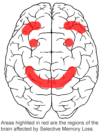 [brainscan.PNG]