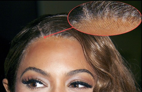 beyonce hairline beyonce hairline