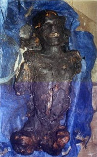Burnt Body