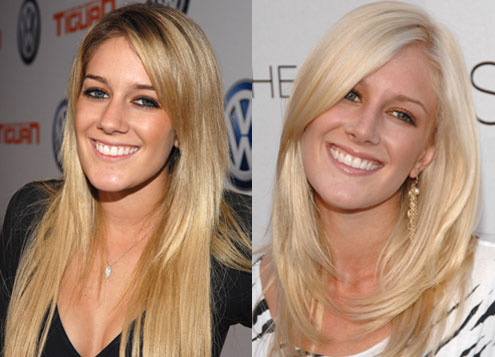 heidi montag plastic surgery face. and after plastic surgery.