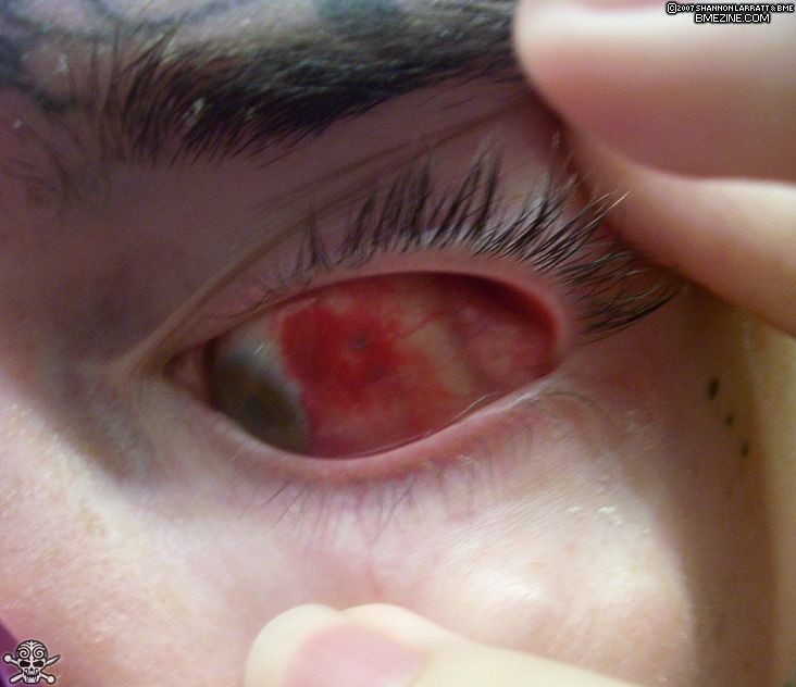 Eyeball Tattoos Banned in Midwest State! Eyeball Tattoos Banned in Midwest State!