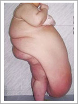 http://4.bp.blogspot.com/_9d19bqV0CCo/SQdFLmLsvCI/AAAAAAAAACY/185nX0ft7PY/s320/turkey_sandwich_pannus.jpg