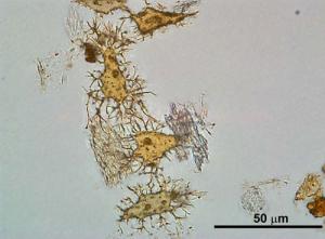 [Hadrosaur_bone_cells.jpg]