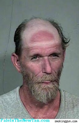 Bad Tan Pictures
