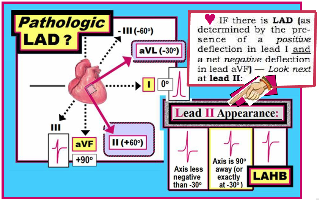 Ekg Waves Meaning