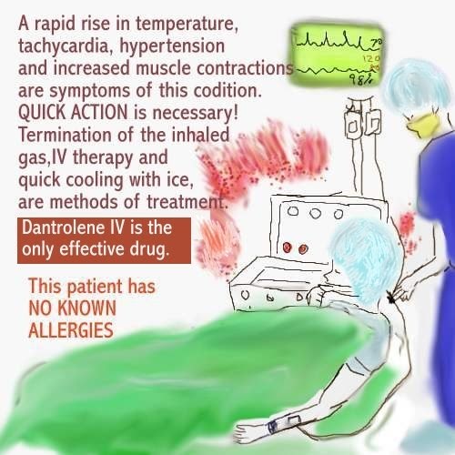 Dear Nurses MALIGNANT HYPERTHERMIA