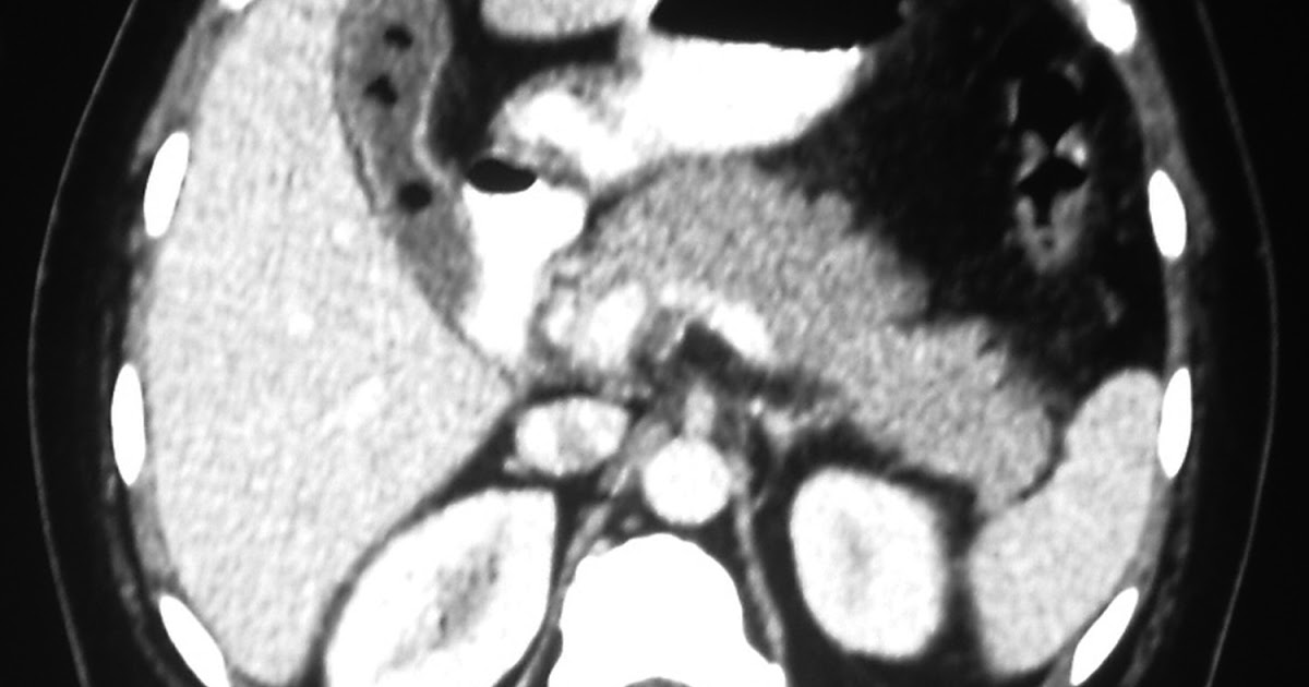 Radiodiagnosis Imaging is AmazingInteresting cases Cholesterol