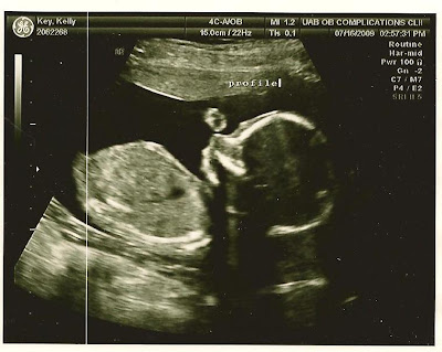 20 week 3d 20 week 3d