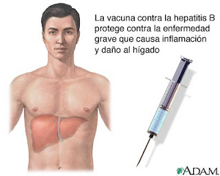 ΗΠΑΤΙΤΙΔΑ