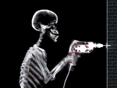 http://4.bp.blogspot.com/_AYwY74fDryU/SNuWEgcQzWI/AAAAAAAAHW8/vvq9_YkbD-4/s400/funny+X-Ray+pictures+1.jpg