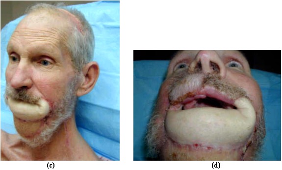 [lips-fig5.jpg]