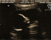 17 weeks - baby's profile