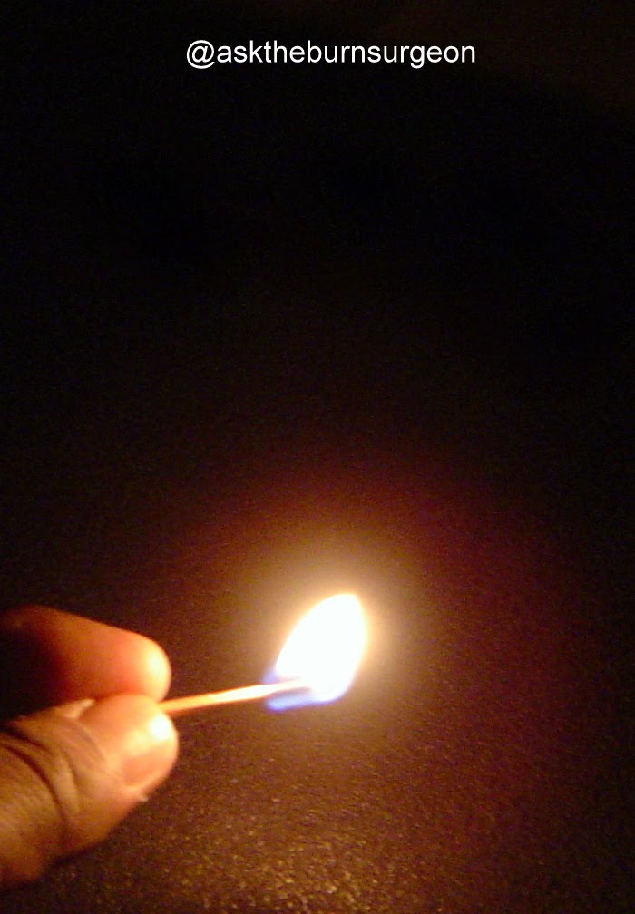 Ask The Burn Surgeon +For Free+ BURN What does 'burn' mean to you?