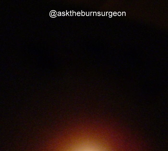 Ask The Burn Surgeon +For Free+ BURN What does 'burn' mean to you?