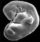human_embryo.jpg