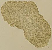 180px-Trichoplax_mic.jpg