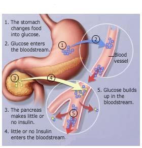 insulin production