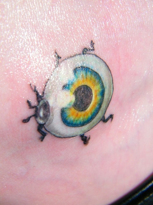 Eyeball Tattoo: This is an allergic reaction after having a henna tattoo The