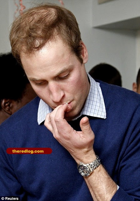 prince william hair. prince william hair thinning. prince william hair. prince william hair. prince william hair thinning.