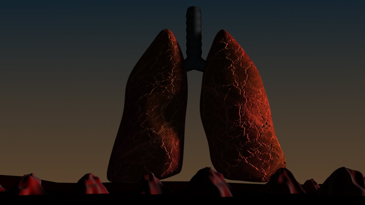 Label the lung's lobes, the Gossip notch, the definitions, larynx, ... Label the lung's lobes, the Gossip notch, the definitions, larynx, ...