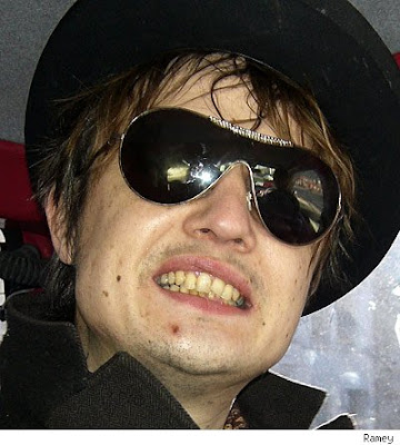pete-doherty-british-teeth.jpg