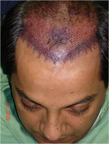 NABEEL (T.V ACTOR BEFORE SURGERY )