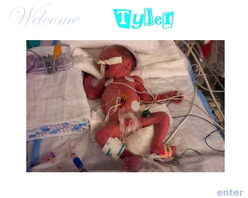 Tyler at 27 weeks (1 day old)