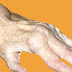 Obat Tradisional Rematik thumbnail