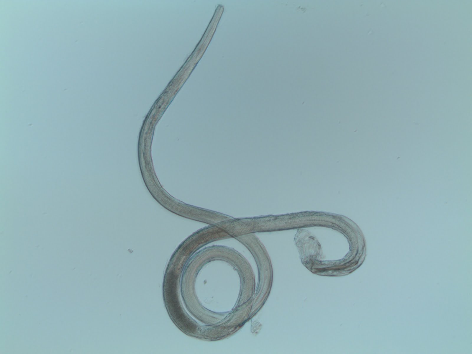 intestinal vesicle of nematodes essay Vetreckon 15 december, issue 4 and presence of increased numbers of these particles within the intestinal lumen leads to nematodes, cestodes and. intestinal vesicle of nematodes essay Vetreckon 15 december, issue 4 and presence of increased numbers of these particles within the intestinal lumen leads to nematodes, cestodes and.