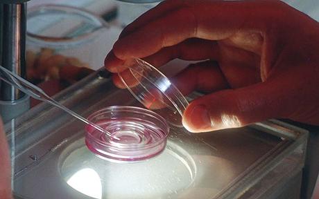 Ovidrel shot out in 7 days? - Fertility.