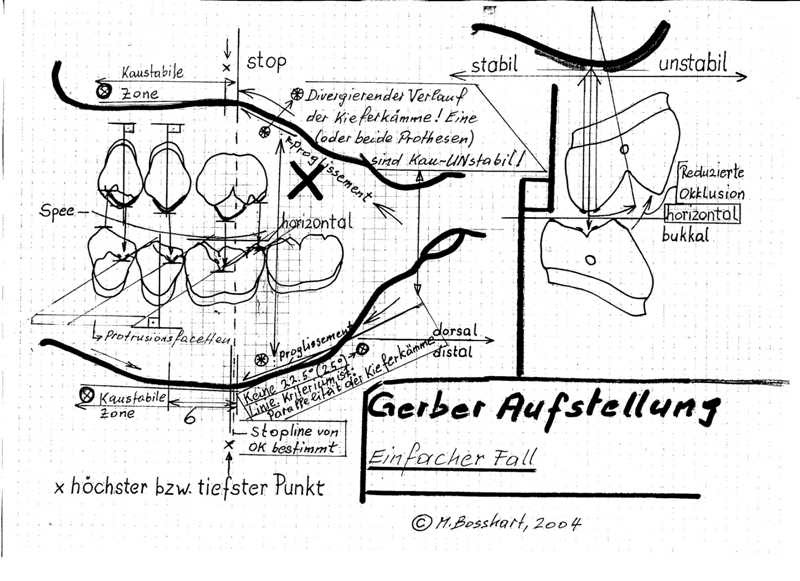eine kleine歯科 檜山比呂 GERBER THEORY その③