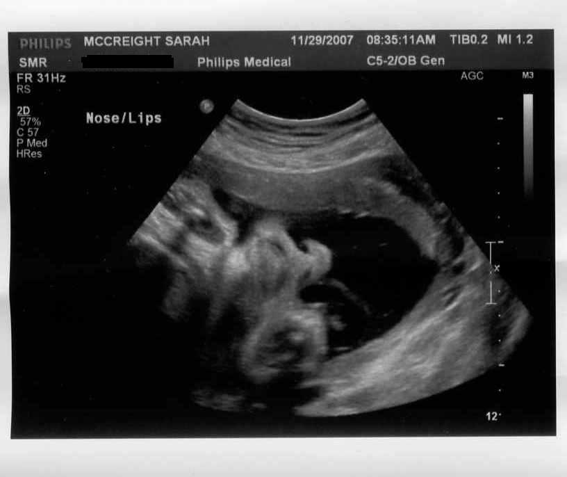 34 Weeks, 2 Days