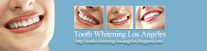 tooth whitening los angeles