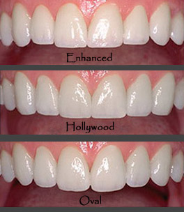 dentique the dental studio cosmetic dentistry designer dentistry and smiles