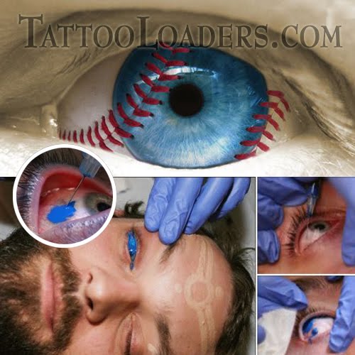 I'm sure eyeball tattoos hurt like hell but people are still getting them 